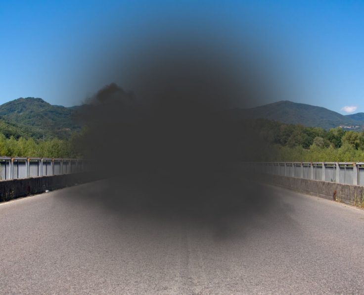 Signs-of-Macular-Degeneration image link