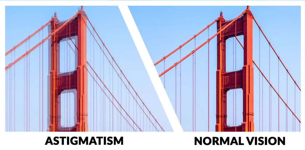 astigmatism image with blurry vision