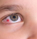 common eye injury decorative image