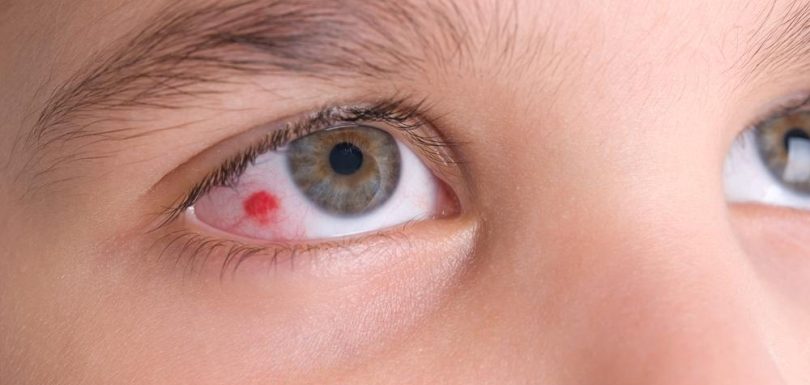common eye injury decorative image