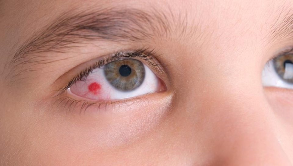 common eye injury decorative image