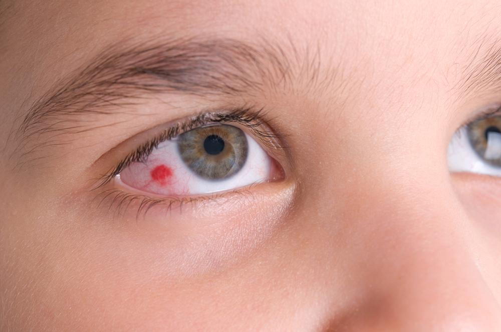 common eye injury decorative image