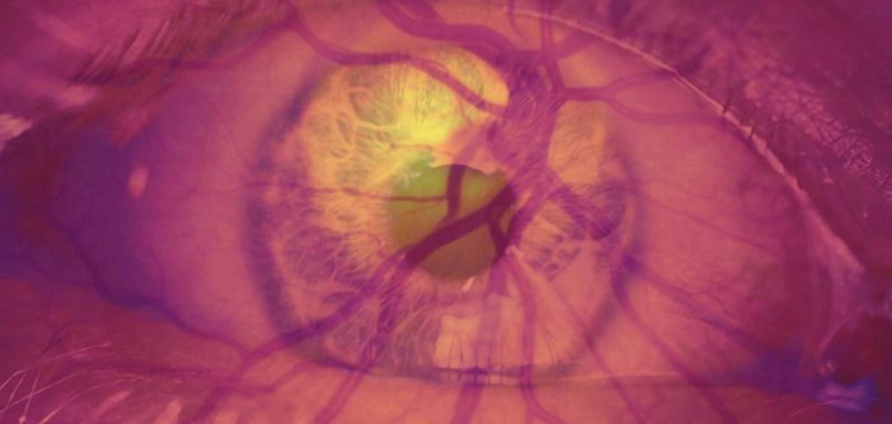 diabetic eye treatments