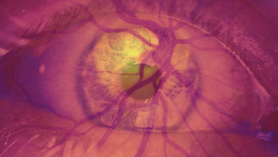 diabetic eye treatments