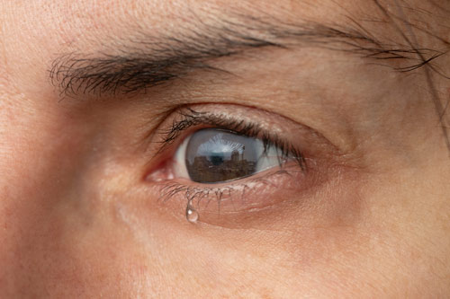 dry eye treatment image link