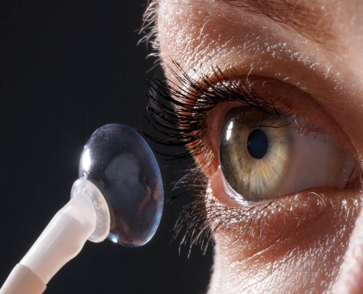 scleral lens fitting image