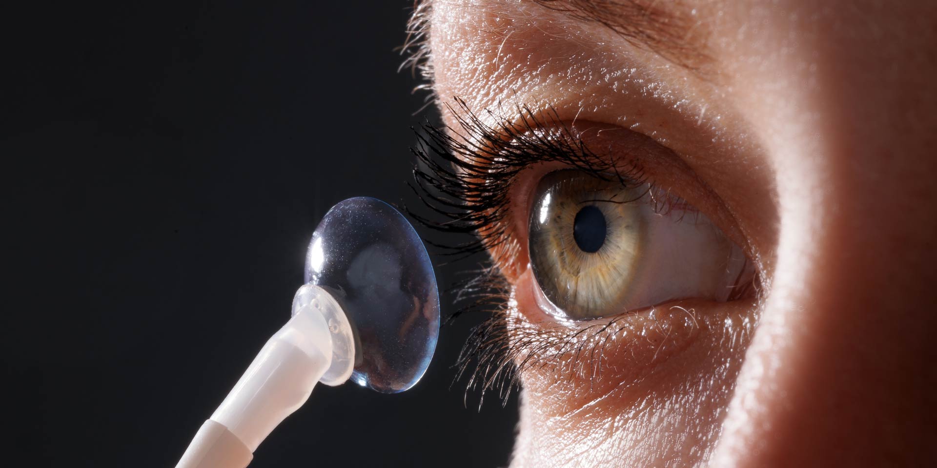 scleral lens fitting image
